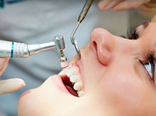 Limpieza Dental Profesional